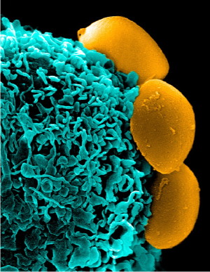 Slipping Drug-Bearing Nanoparticles Past the Immune System