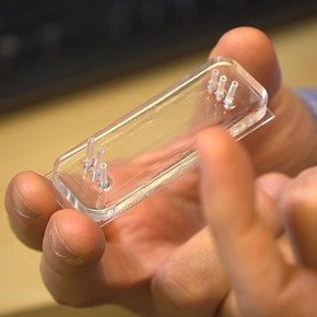 Microfluidic Device Detects Transfusion Need