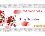Nanocapsule Delivers Drugs Directly to Blood Clots
