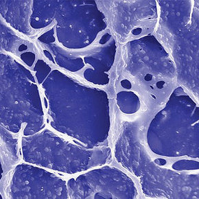 Nanogel Kills Lingering Cancer Cells