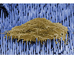 Nanoneedles Speed Healing With DNA