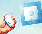 Nanova Portable Pressure Wound Therapy System