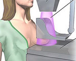 Optical Scanner Detects Cancer in Dense Tissue