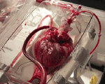 Organ Care System Can Hold a Beating Heart