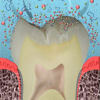Peptide Toothpaste Repairs Cavities