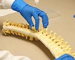 Polymer Implant Expands to Fill Gaps in the Spine