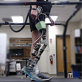 Prosthetic Knee Aided by Machine Learning
