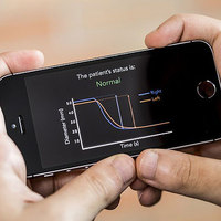 PupilSceen App Detects Concussions with a Smartphone
