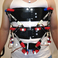 RoSE Exoskeleton Helps Treat Spinal Deformities