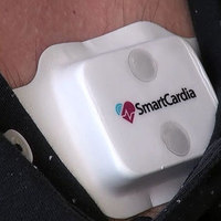 Smartcardia Patch Eases ER Data Collection