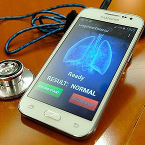Smartphone Device Listens for Heart Failure