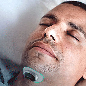 Snore Circle Smart Anti-Snoring Muscle Stimulator