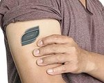 The sugarBEAT Patch Offers Continuous Glucose Monitoring