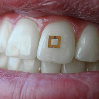 Tooth Patch Monitors Diet