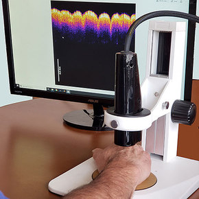 Virtual Biopsy Offers Painless Assessment