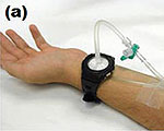 Wearable Nanomesh Could Replace Dialysis Machines