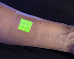 Wound Dressing Glows in Presence of Biofilm